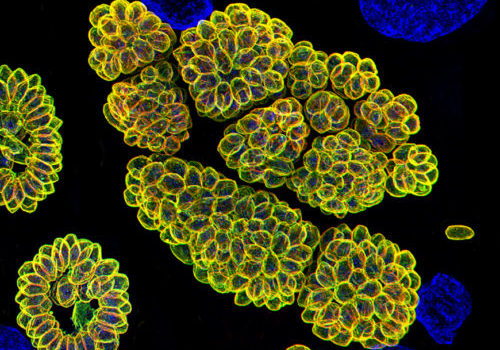 Toxoplasma-SIM-image-small-e1501099440761